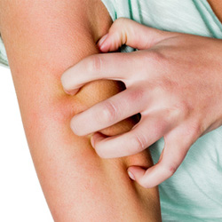 Behandlung von Allergien und Ekzemen